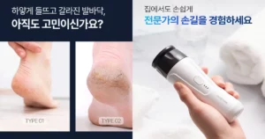 라셀턴 발각질 제거기 효과 사용법 가격 총정리 및 솔직 후기